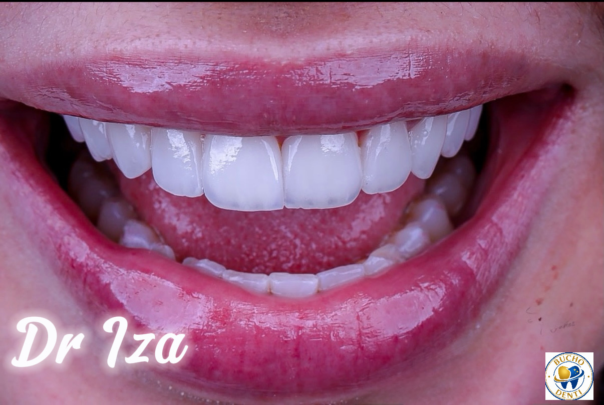 Dental Tourism in Georgia: Why International Patients Choose BuchoDenti Clinic in Tbilisi