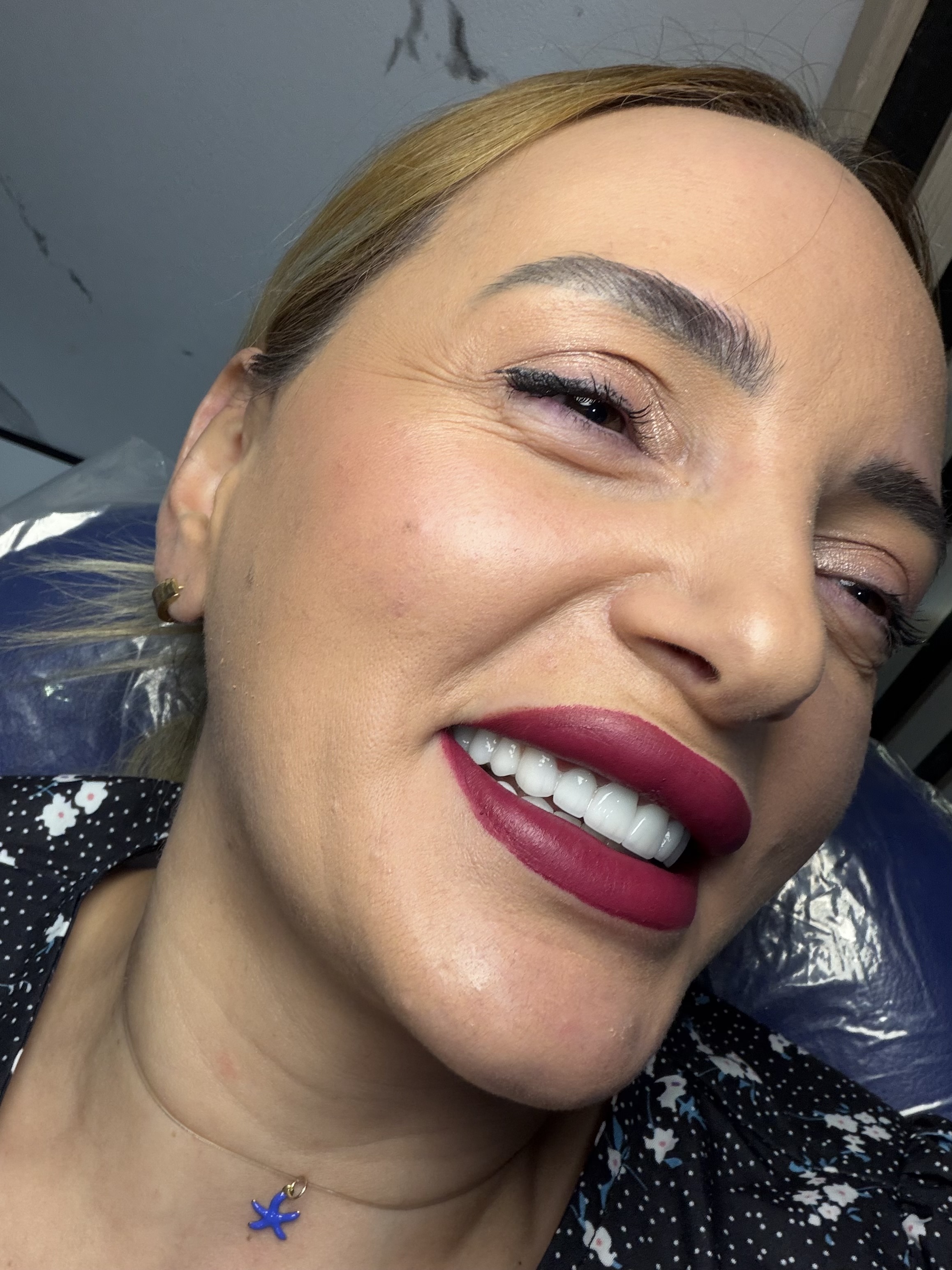 Dental Implants in Georgia: How to Choose a Trusted Clinic Abroad