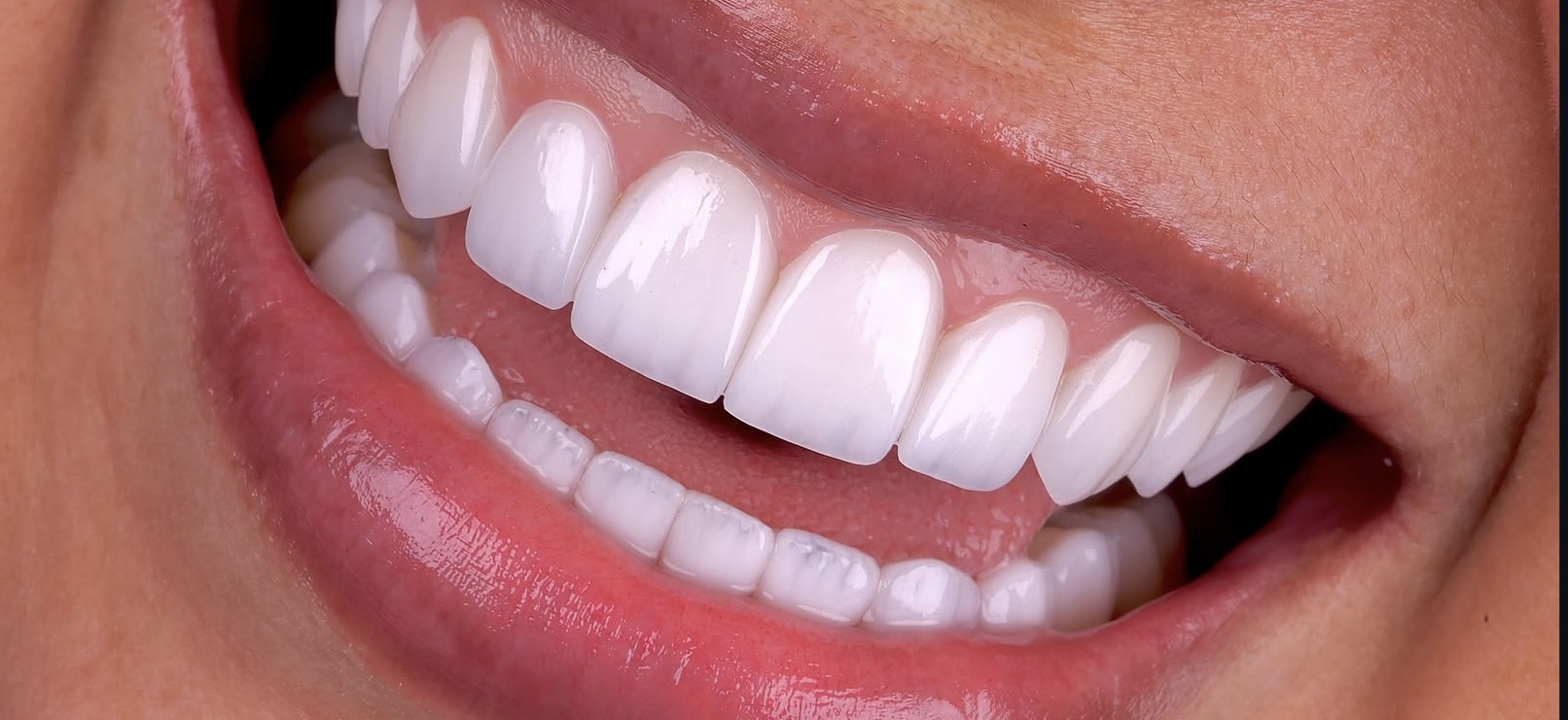Dental Tourism in Georgia: A Complete Guide for International Patients