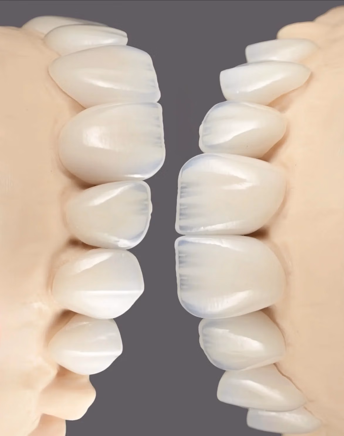   How International Patients Prepare for Dental Treatment in Georgia | BuchoDenti