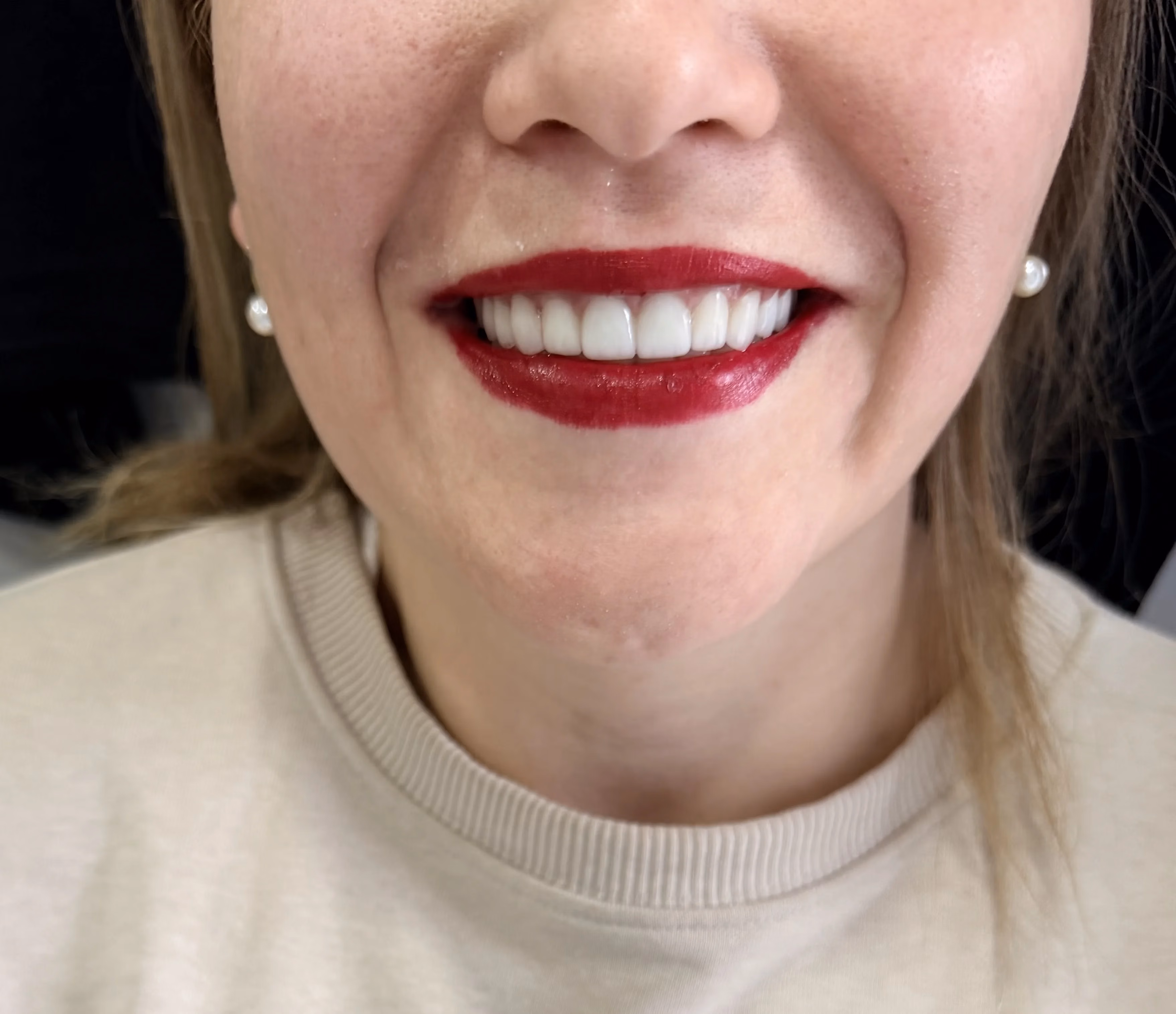 Why Trust Matters When Choosing Dental Implants in Georgia | BuchoDenti