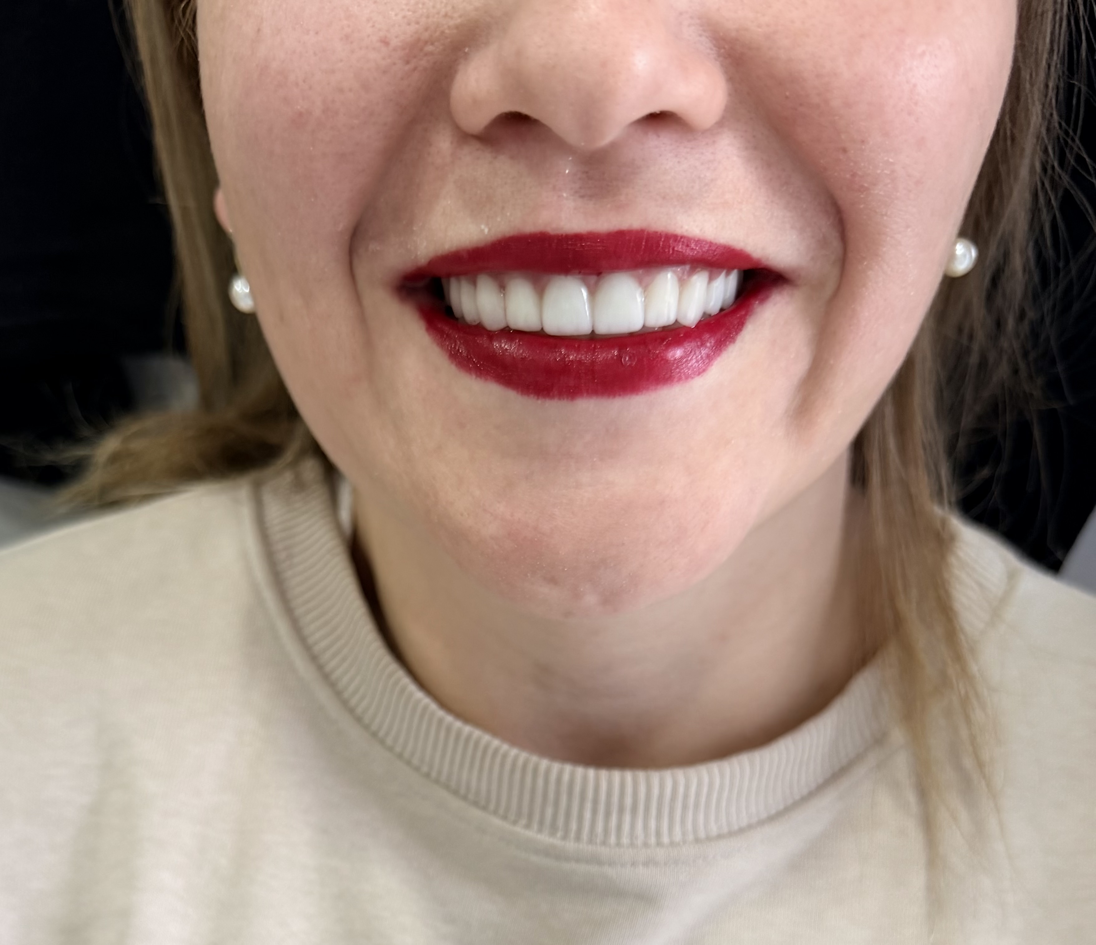 Why Trust Matters When Choosing Dental Implants in Georgia | BuchoDenti