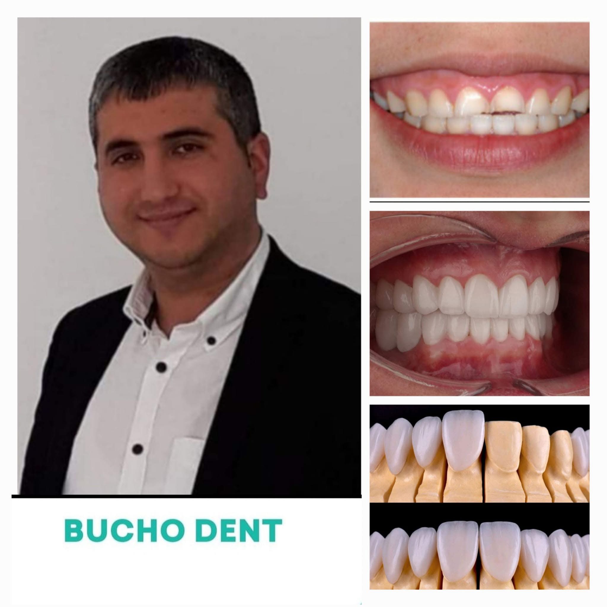 Dental Implant Treatment Timeline in Georgia: What International Patients Should Expect