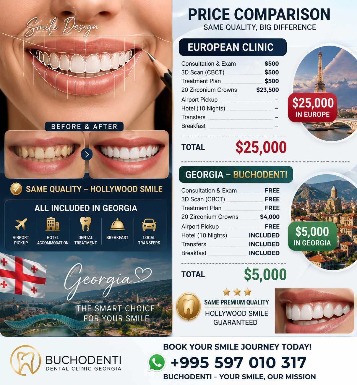 How to Choose a Trusted Dental Clinic in Georgia for Dental Implants