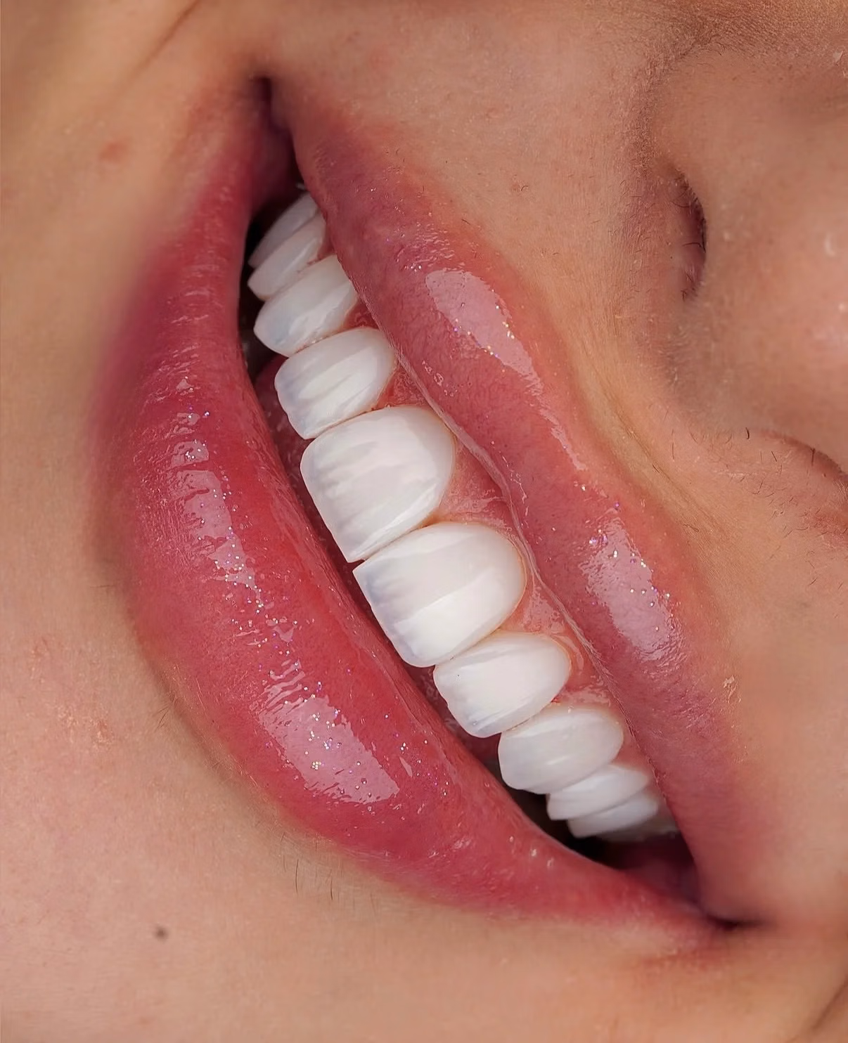  Dental Implant Treatment Planning in Georgia: Why Diagnosis Comes First