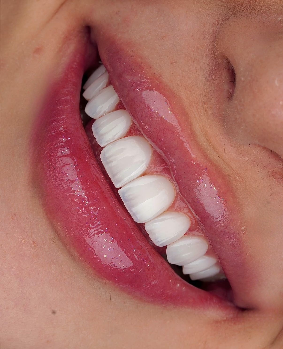  Dental Implant Treatment Planning in Georgia: Why Diagnosis Comes First