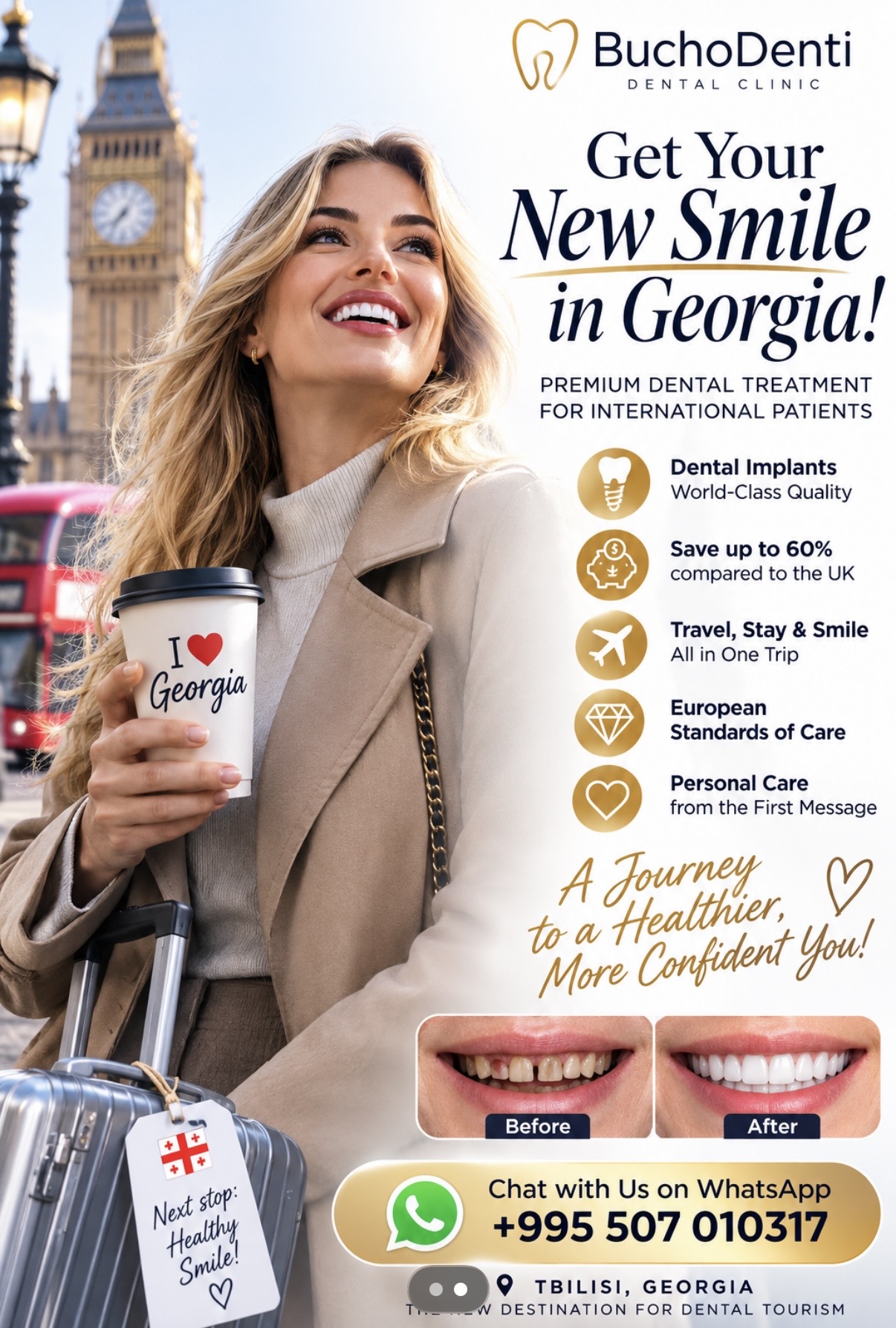 Dental Implant Treatment Plan in Georgia: Why Diagnosis Comes First | BuchoDenti Tbilisi