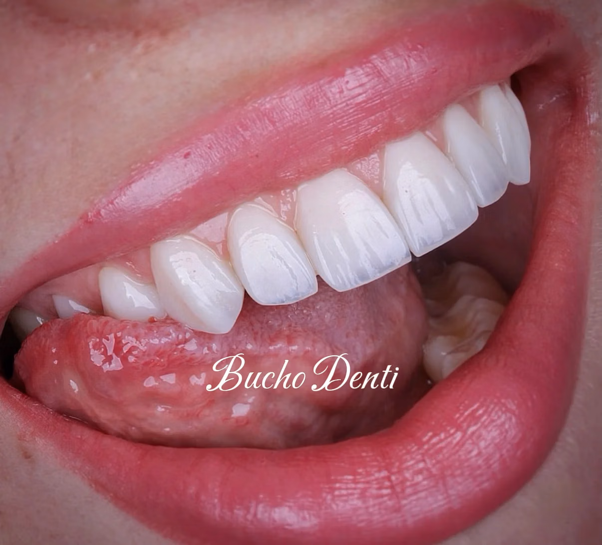 Real Dental Implant Case in Georgia | Diagnosis to Final Restoration
