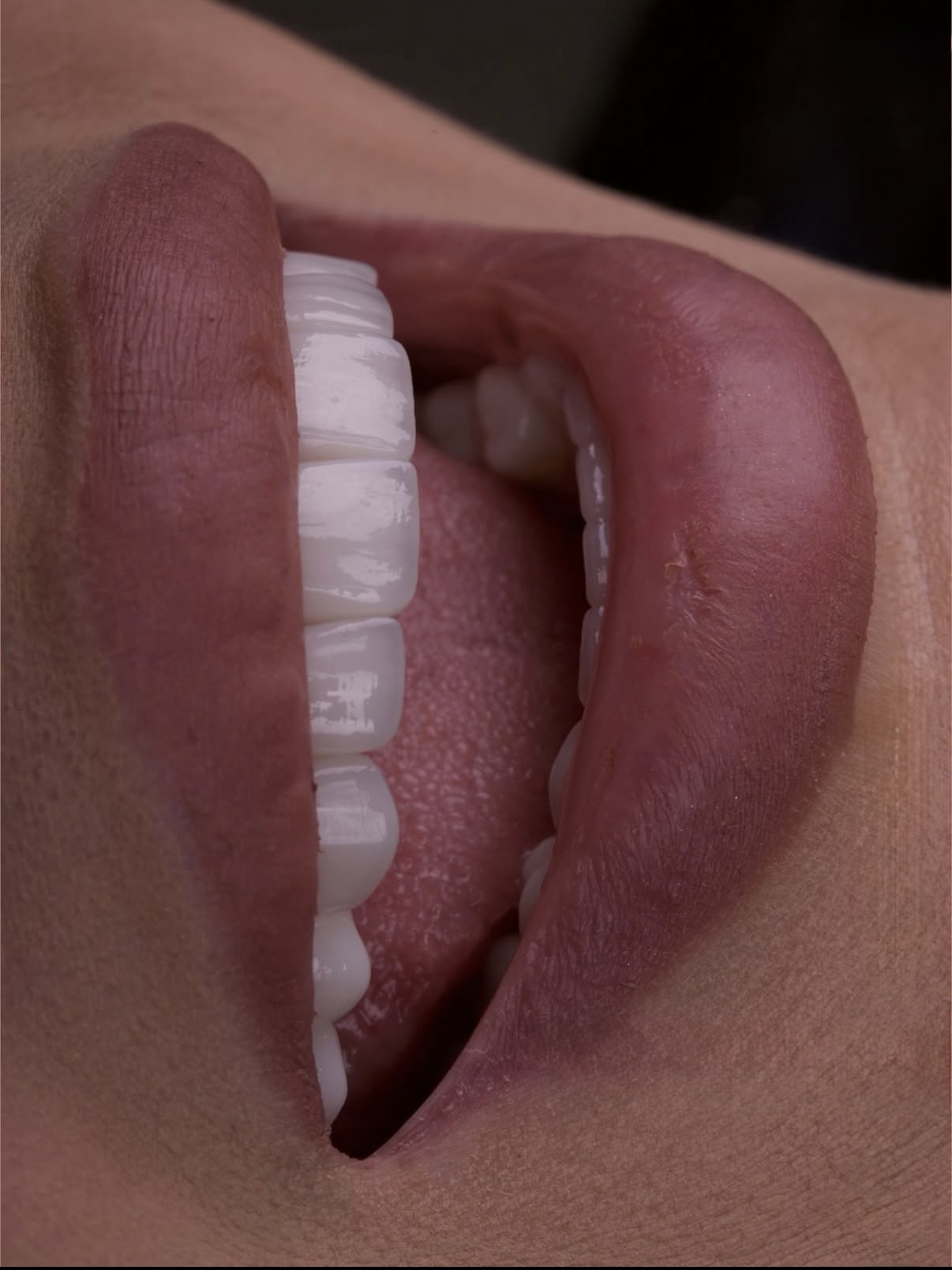 Dental Implant Clinical Decision Making | BuchoDenti Georgia
