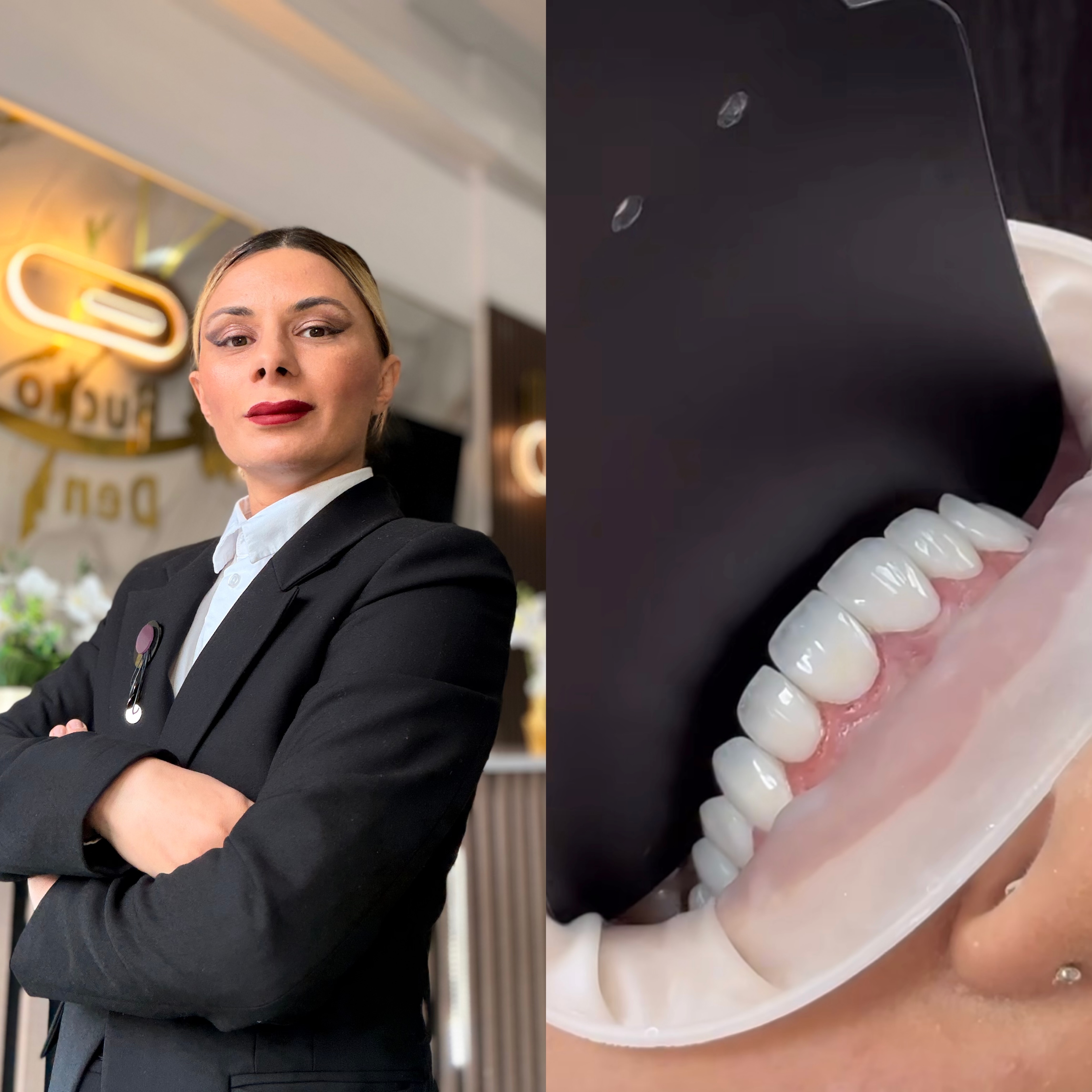 How International Patients Can Plan Dental Implant Treatment in Georgia Before They Travel