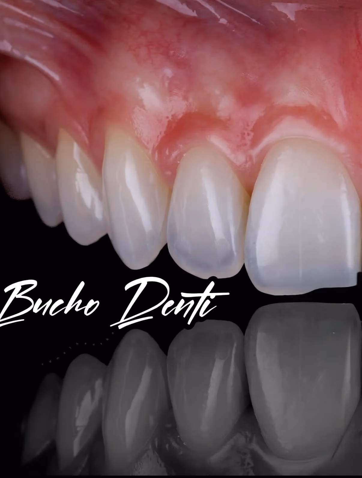 Dental Implants in Georgia: The Complete Guide for UK & Israel Patients (2026)