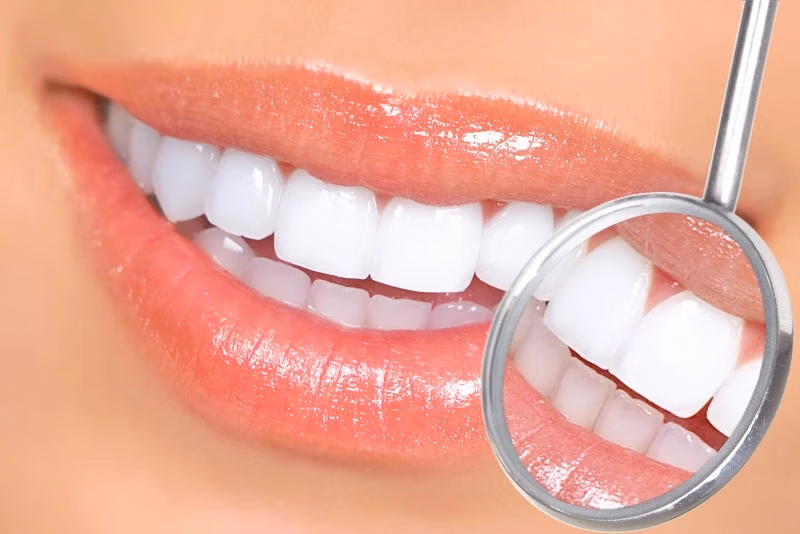 Esthetic Dentistry