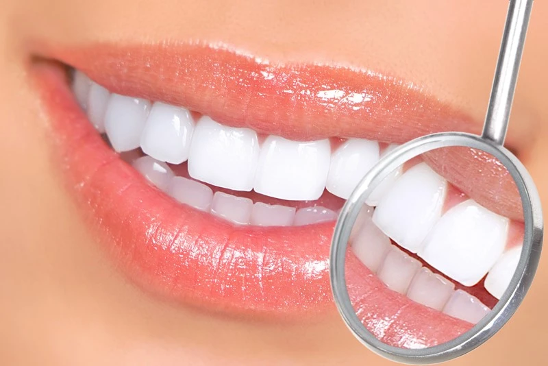 ესთეტიკური სტომატოლოგია - Dental Service Tbilisi