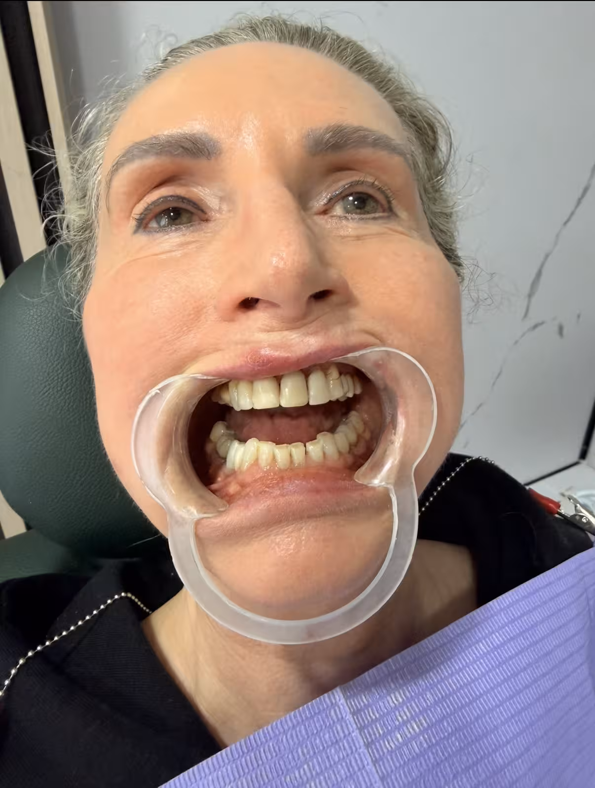 Initial Dental Condition