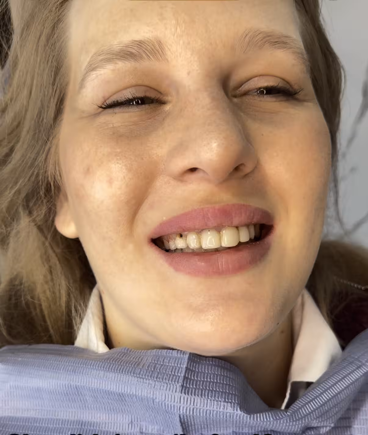Initial Dental Condition