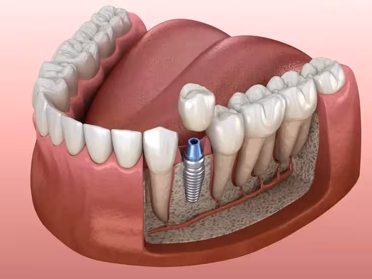 Dental Therapy